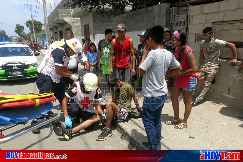 Hoy Tamaulipas Motociclista Se Fractura Una Pierna Al Derrapar En