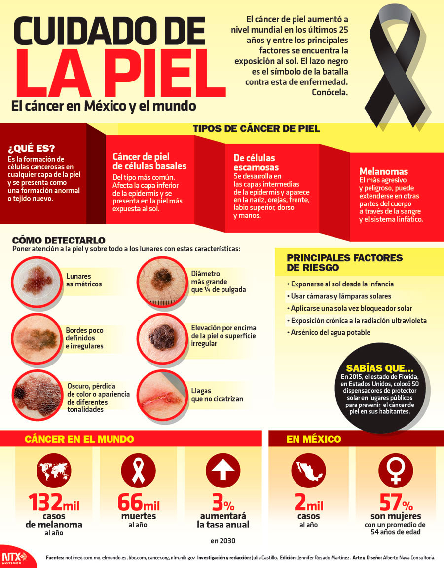 Hoy Tamaulipas Infografía Cuidado De La Piel 4396