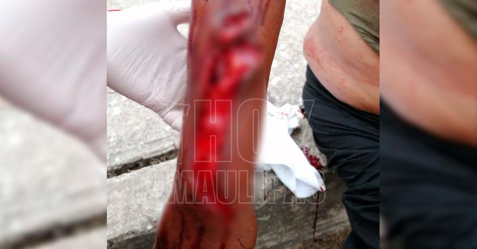 Hoy Tamaulipas - Seguridad Cocodrilo casi le amputa brazo a mujer en la  Laguna del Carpintero en Tampico